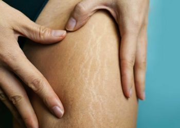 ترک پوستی چیست؟